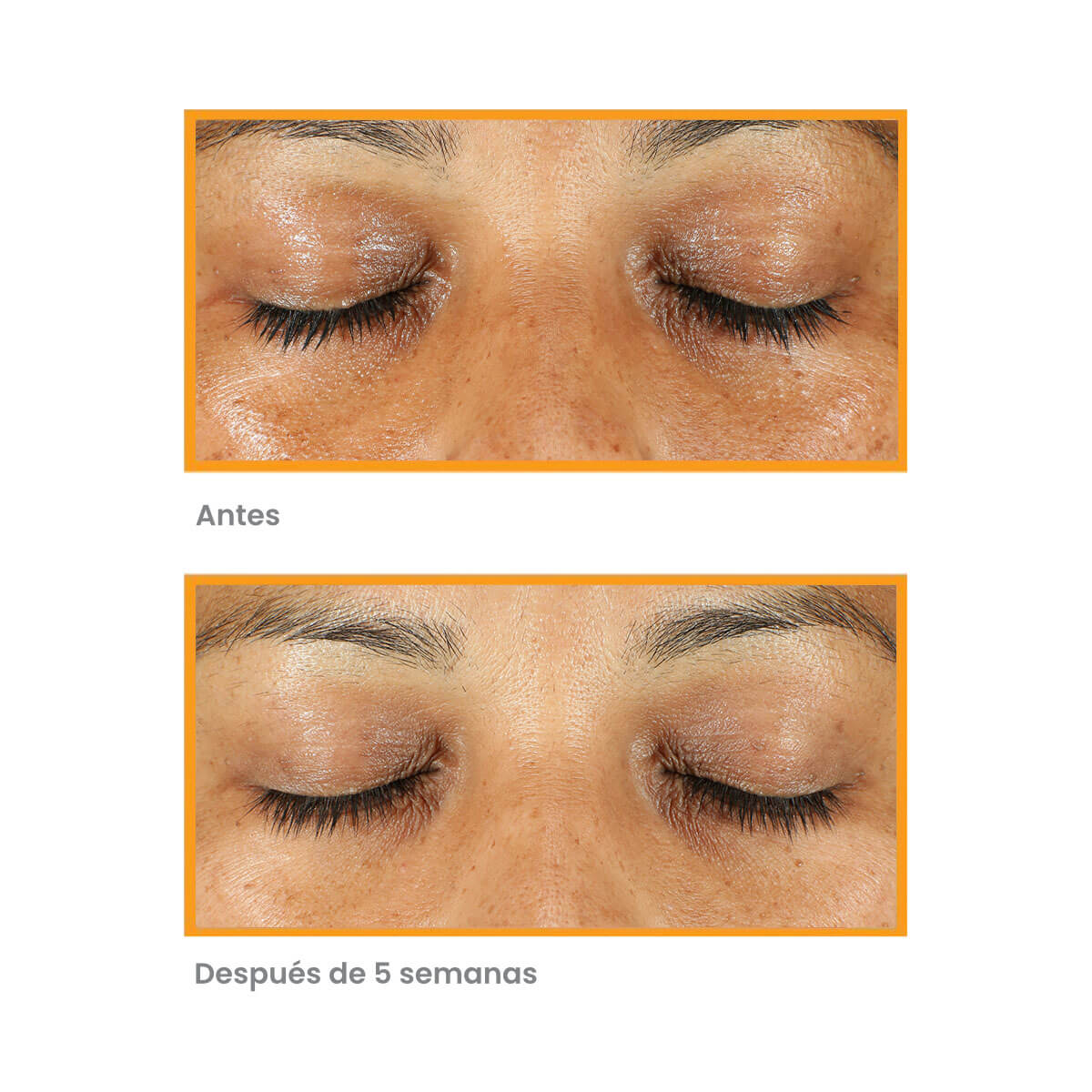VITA-C EYES DARK CIRCLE CORRECTOR (SUERO DE OJOS CON VITAMINA C)